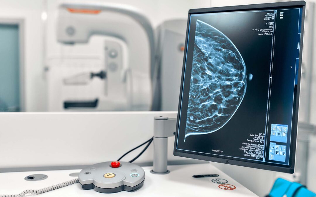 Mammografia 3D con Tomosintesi