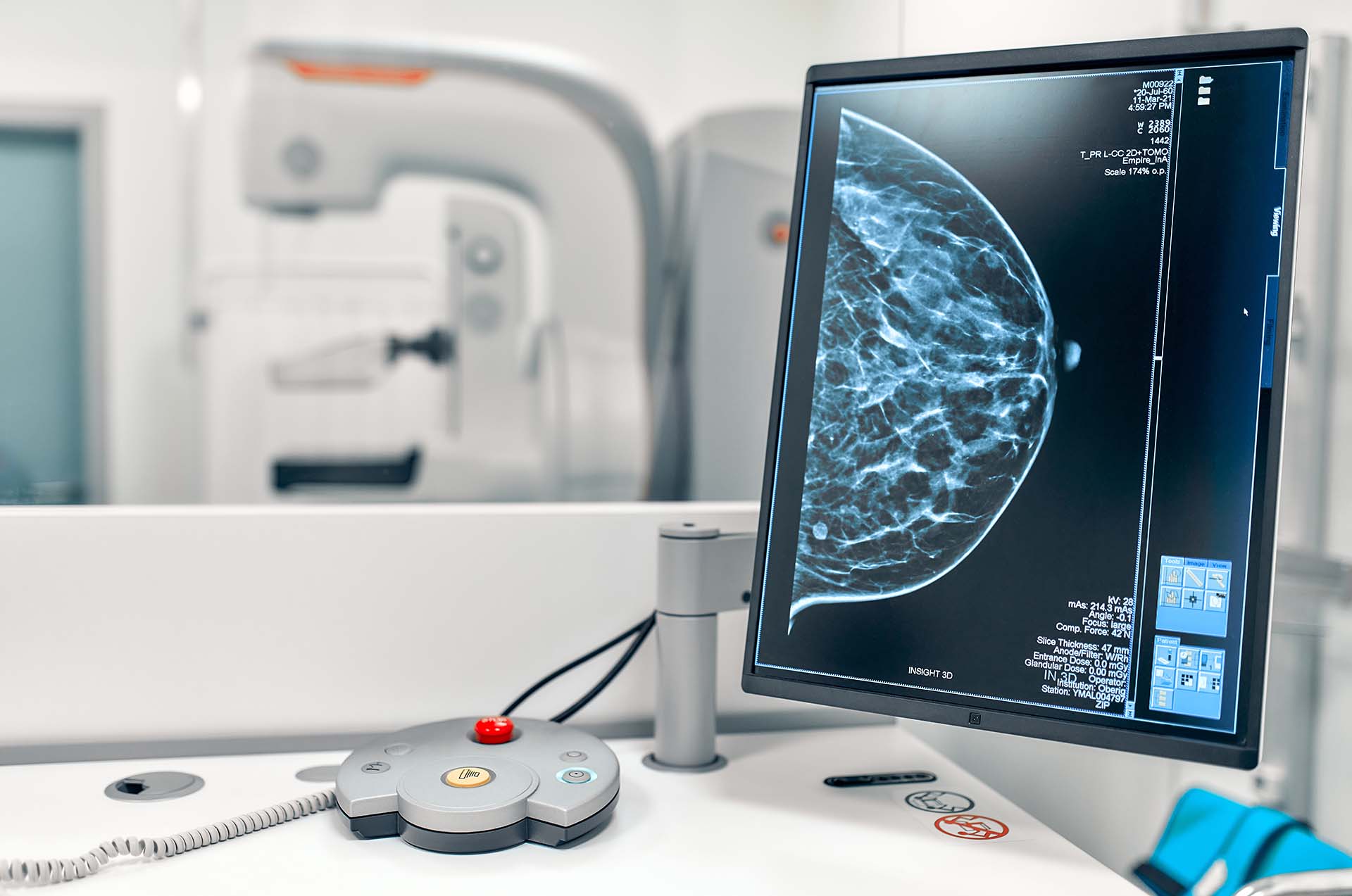 La mammografia 3D con tomosintesi è una tecnica di imaging avanzata, utilizzata nella diagnosi precoce del tumore al seno.